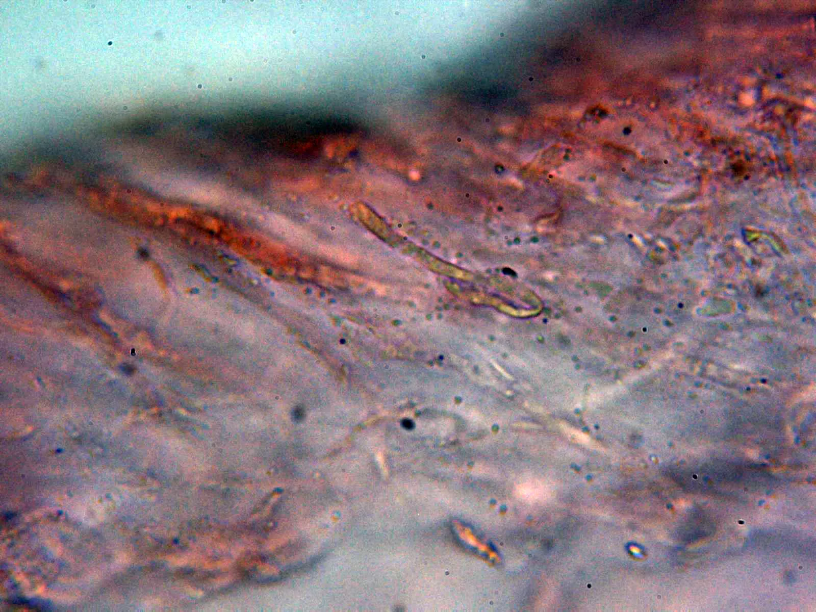 Microscopía de Mycena amicta - 10 - Hifas suprapellis 3